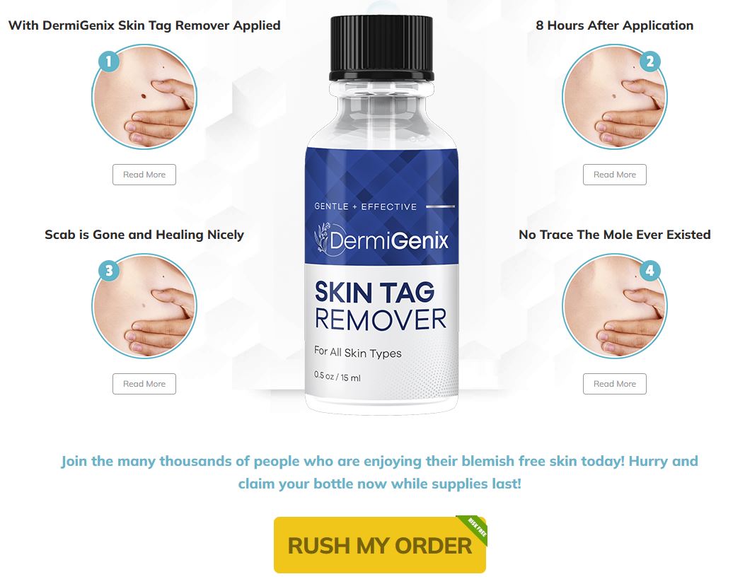 DermiGenix Skin Tag Remover