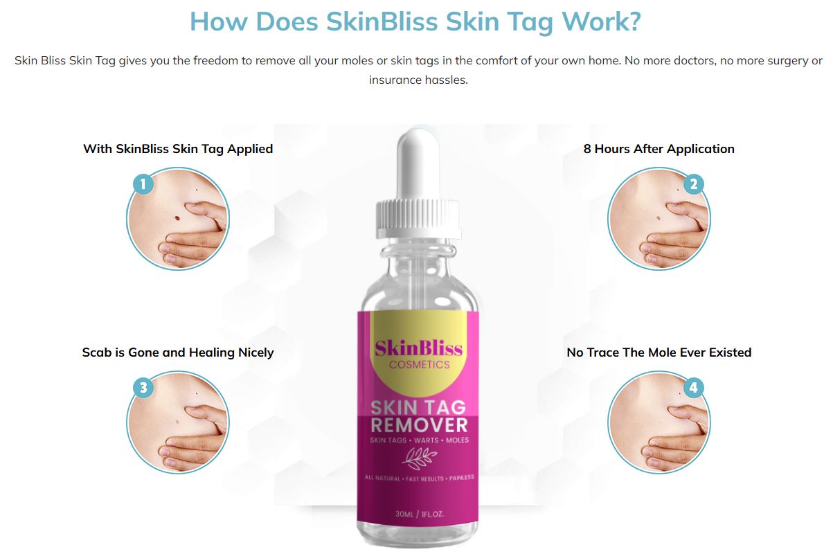 SkinBliss Skin Tag Remover