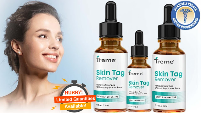 Treme Skin Tag Remover: Fast, Painless, and Natural Solution